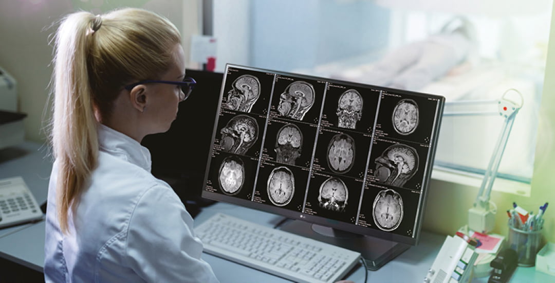 Medical professional analyzes brain scans