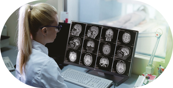 Medical professional analyzes brain scans